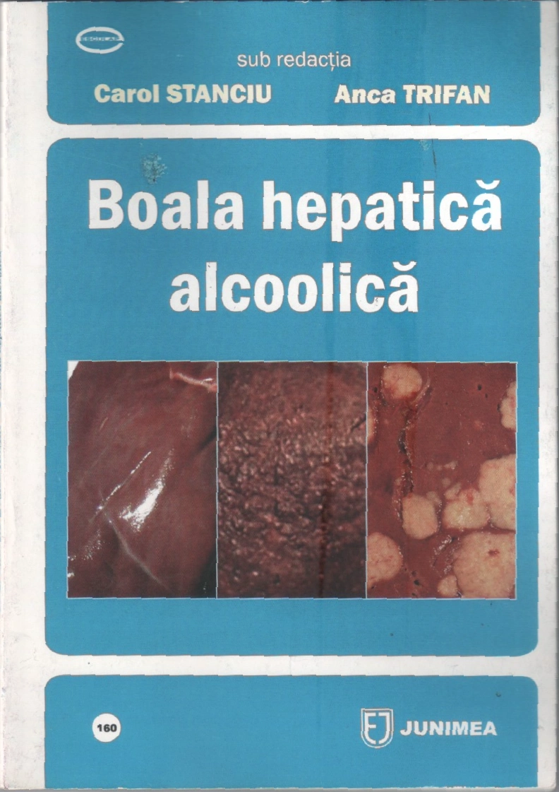 BOALA HEPATICÃ ALCOOLICÃ Anca Trifan